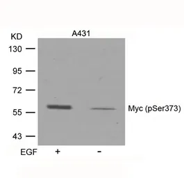 Anti-c-Myc (phospho Ser373) antibody used in Western Blot (WB). GTX50113