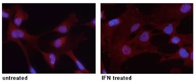 Anti-STAT3 (phospho Tyr705) antibody used in Immunocytochemistry/ Immunofluorescence (ICC/IF). GTX50119