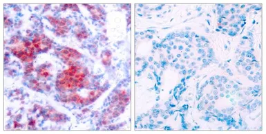 Anti-STAT4 (phospho Tyr693) antibody used in IHC (Paraffin sections) (IHC-P). GTX50121