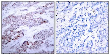 Anti-ATF4 (phospho Ser245) antibody used in IHC (Paraffin sections) (IHC-P). GTX50127