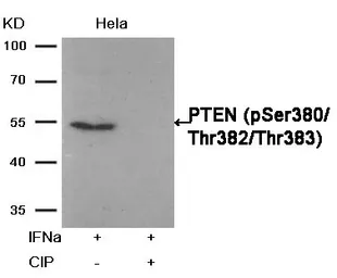 Anti-PTEN (phospho Ser380/Thr382/Thr383) antibody used in Western Blot (WB). GTX50130