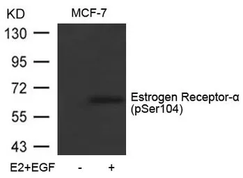 Anti-Estrogen Receptor alpha (phospho Ser104) antibody used in Western Blot (WB). GTX50137