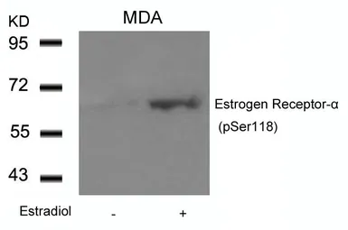 Anti-Estrogen Receptor alpha (phospho Ser118) antibody used in Western Blot (WB). GTX50139