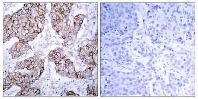 Anti-EGFR (phospho Tyr1068) antibody used in IHC (Paraffin sections) (IHC-P). GTX50148