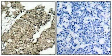 Anti-G3BP1 (phospho Ser232) antibody used in IHC (Paraffin sections) (IHC-P). GTX50149
