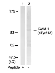 Anti-ICAM1 / CD54 (phospho Tyr512) antibody used in Western Blot (WB). GTX50150