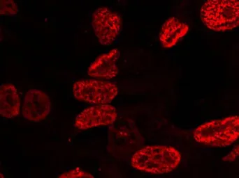Anti-p53 (phospho Ser15) antibody used in Immunocytochemistry/ Immunofluorescence (ICC/IF). GTX50158