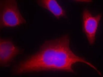 Anti-PKC mu (phospho Ser910) antibody used in Immunocytochemistry/ Immunofluorescence (ICC/IF). GTX50160