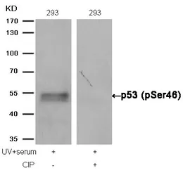Anti-p53 (phospho Ser46) antibody used in Western Blot (WB). GTX50163