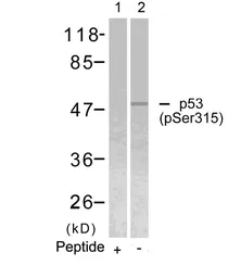 Anti-p53 (phospho Ser315) antibody used in Western Blot (WB). GTX50164