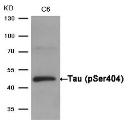 Anti-Tau (phospho Ser404) antibody used in Western Blot (WB). GTX50176