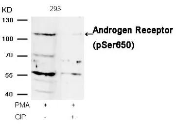 Anti-Androgen Receptor (phospho Ser650) antibody used in Western Blot (WB). GTX50183