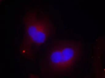 Anti-FAK (phospho Tyr925) antibody used in Immunocytochemistry/ Immunofluorescence (ICC/IF). GTX50185