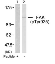 Anti-FAK (phospho Tyr925) antibody used in Western Blot (WB). GTX50185