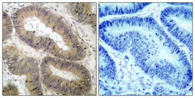 Anti-IKK alpha (phospho Thr23) antibody used in IHC (Paraffin sections) (IHC-P). GTX50190