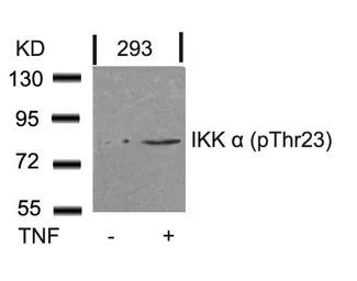 Anti-IKK alpha (phospho Thr23) antibody used in Western Blot (WB). GTX50190