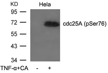 Anti-CDC25A (phospho Ser76) antibody used in Western Blot (WB). GTX50198