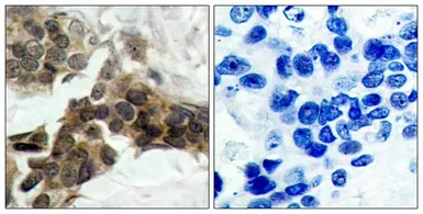 Anti-IKB alpha (phospho Ser32/Ser36) antibody used in IHC (Paraffin sections) (IHC-P). GTX50209