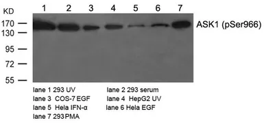 Anti-ASK1 (phospho Ser966) antibody used in Western Blot (WB). GTX50229