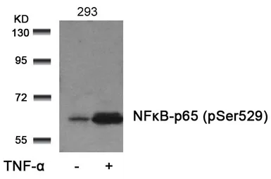 Anti-NFkB p65 (phospho Ser529) antibody used in Western Blot (WB). GTX50254
