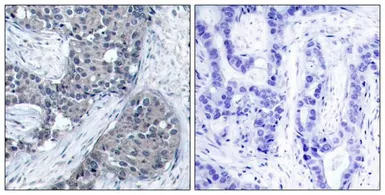 Anti-eIF4E (phospho Ser209) antibody used in IHC (Paraffin sections) (IHC-P). GTX50268