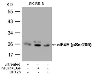 Anti-eIF4E (phospho Ser209) antibody used in Western Blot (WB). GTX50268