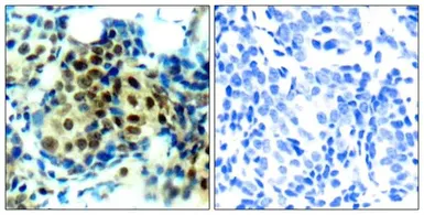 Anti-ERK1 (phospho Thr202) + ERK2 (phospho Thr185) antibody used in IHC (Paraffin sections) (IHC-P). GTX50274
