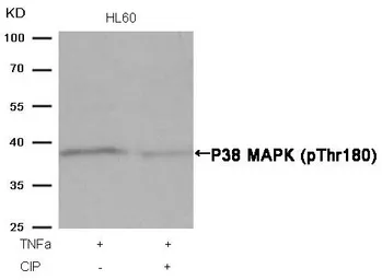 Anti-p38 MAPK (phospho Thr180) antibody used in Western Blot (WB). GTX50280