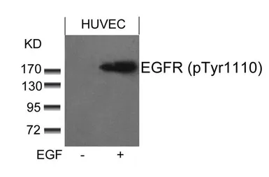 Anti-EGFR (phospho Tyr1086) antibody used in Western Blot (WB). GTX50289