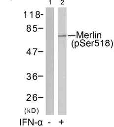 Anti-Merlin (phospho Ser518) antibody used in Western Blot (WB). GTX50291