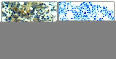 Anti-p70 S6K (phospho Ser411) antibody used in IHC (Paraffin sections) (IHC-P). GTX50294