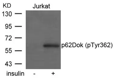 Anti-p62Dok (phospho Tyr362) antibody used in Western Blot (WB). GTX50297