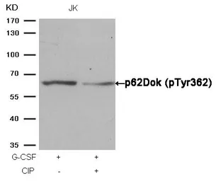 Anti-p62Dok (phospho Tyr362) antibody used in Western Blot (WB). GTX50297