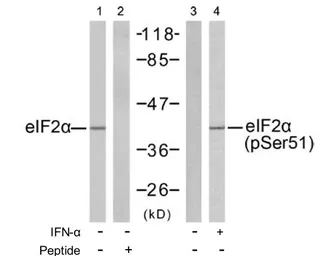 Anti-eIF2 alpha (phospho Ser51) antibody used in Western Blot (WB). GTX50300