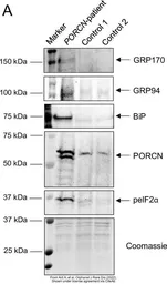 Anti-eIF2 alpha (phospho Ser51) antibody used in Western Blot (WB). GTX50300