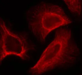 Anti-p70 S6K (phospho Ser424) antibody used in Immunocytochemistry/ Immunofluorescence (ICC/IF). GTX50304