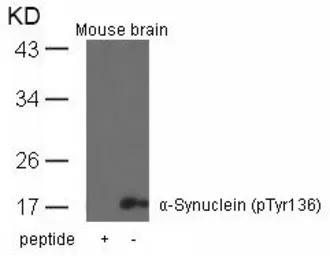 Anti-alpha Synuclein (phospho Tyr136) antibody used in Western Blot (WB). GTX50306