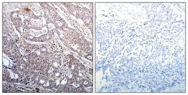 Anti-IKB beta (phospho Ser23) antibody used in IHC (Paraffin sections) (IHC-P). GTX50317