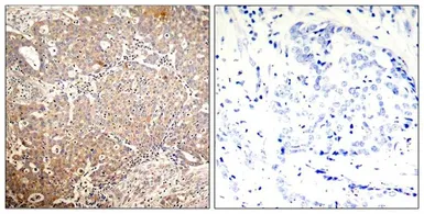 Anti-Cytokeratin 18 (phospho Ser33) antibody used in IHC (Paraffin sections) (IHC-P). GTX50318