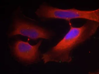 Anti-Cytokeratin 8 (phospho Ser74) antibody used in Immunocytochemistry/ Immunofluorescence (ICC/IF). GTX50320