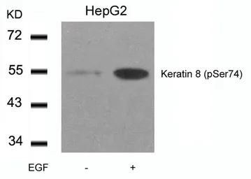 Anti-Cytokeratin 8 (phospho Ser74) antibody used in Western Blot (WB). GTX50320