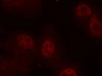 Anti-c-Myc (phospho Ser62) antibody used in Immunocytochemistry/ Immunofluorescence (ICC/IF). GTX50323