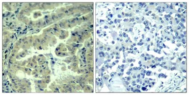 Anti-eIF4G (phospho Ser1232) antibody used in IHC (Paraffin sections) (IHC-P). GTX50344