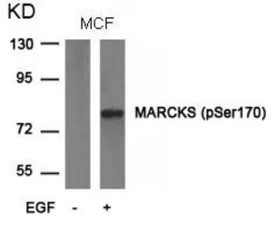 Anti-MARCKS (phospho Ser170) antibody used in Western Blot (WB). GTX50348