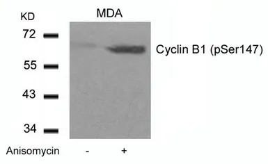 Anti-Cyclin B1 (Phospho Ser147) antibody used in Western Blot (WB). GTX50351