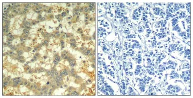 Anti-Syk (phospho Tyr323) antibody used in IHC (Paraffin sections) (IHC-P). GTX50355