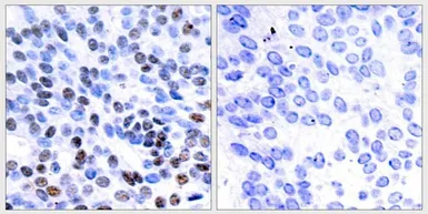 Anti-JunB antibody used in IHC (Paraffin sections) (IHC-P). GTX50387