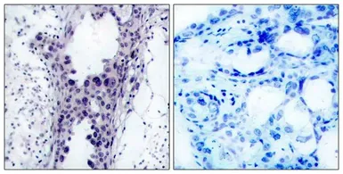 Anti-PTEN antibody used in IHC (Paraffin sections) (IHC-P). GTX50411