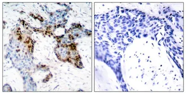 Anti-Estrogen Receptor alpha antibody used in IHC (Paraffin sections) (IHC-P). GTX50420