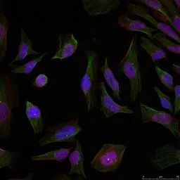 Anti-Progesterone Receptor antibody used in Immunocytochemistry/ Immunofluorescence (ICC/IF). GTX50422